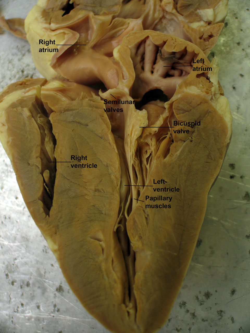 Sheep Heart Dissection